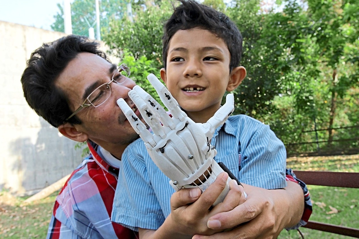Sujana helping a child wear a mechanical limb using his 3d printer.