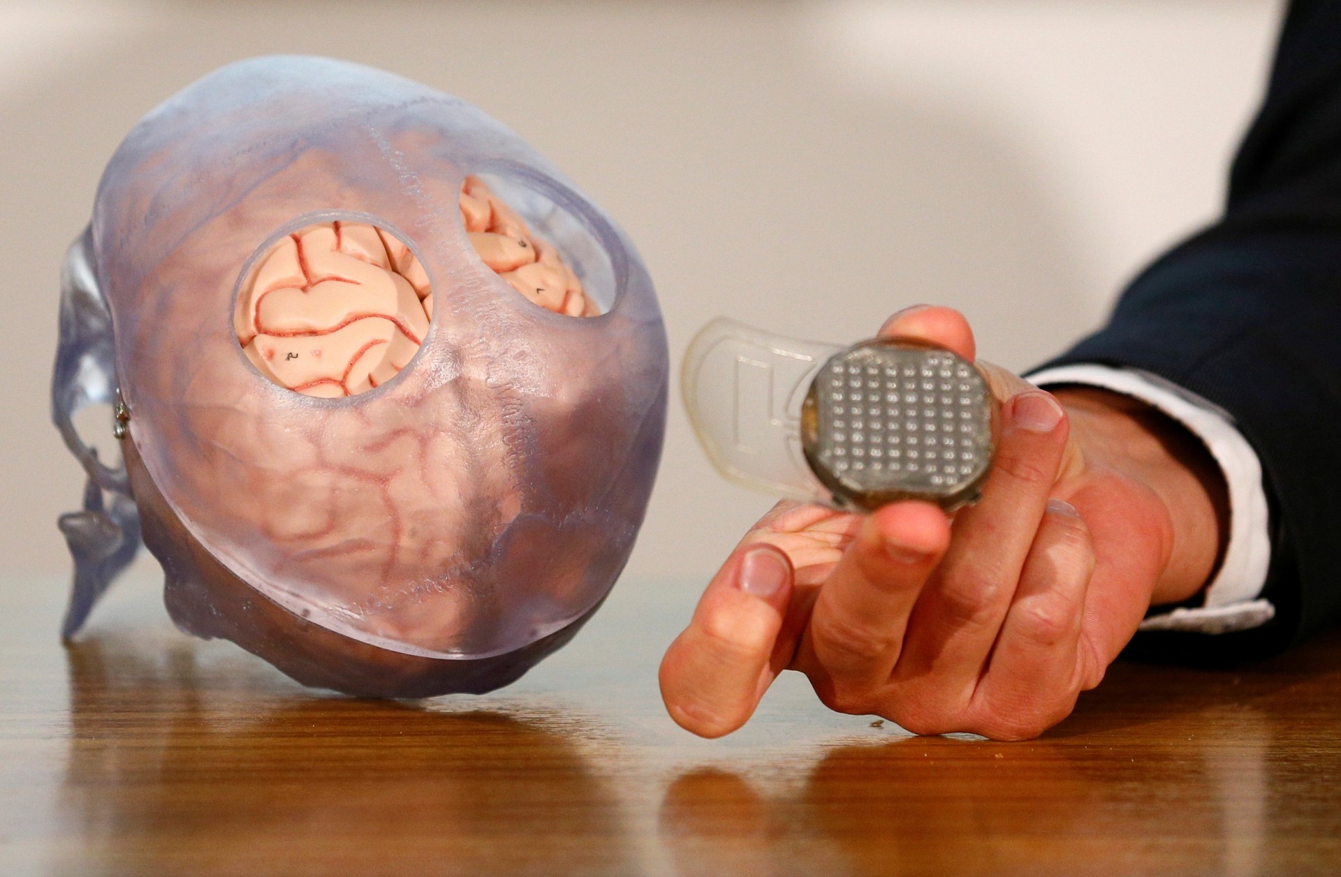 Benabid showing one of two recording devices containing 64 electrodes which collected brain signals to be implanted one on either side of the patient's head during a news conference after Thibault had been able to walk using a robotic exoskeleton controlled by his own mind, at the French research center Clinatec in Grenoble, France. — Reuters