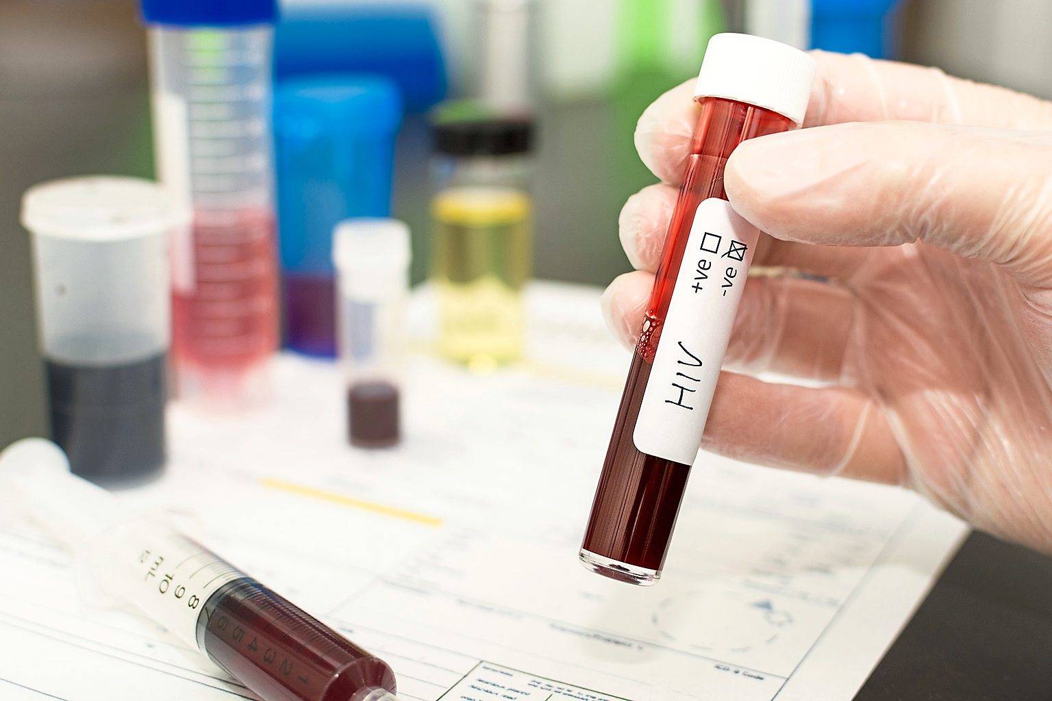 Voluntary Screening For Hiv Still Too Low The Star