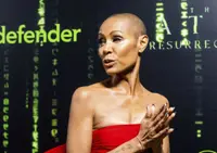Jada Pinkett Smith opens up about having alopecia which causes bald spots, hair loss