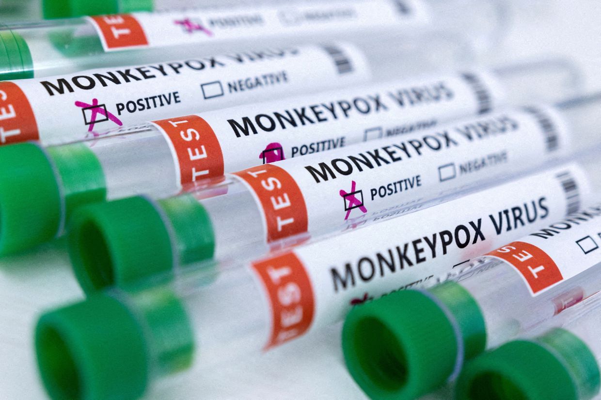 Second monkeypox case reported in Vietnam - Vimarsana News