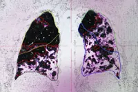 AI fails radiology qualifying exam, human touch still superior