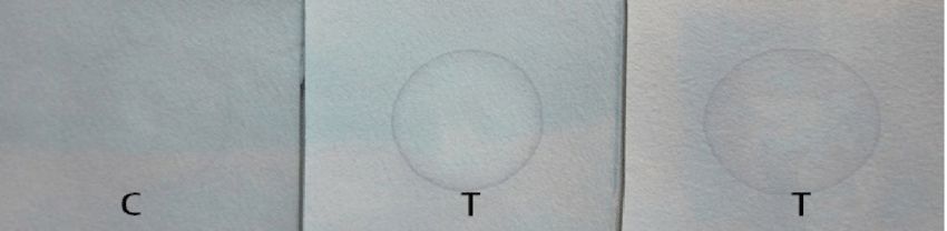The toluidine blue-spot test, also known as the Berry spot test, for MPS; C indicates the control sample, while T indicates positive test samples. — NAVEEN K SHREEVASTAVA and ARTI S PANDEY via Researchgate