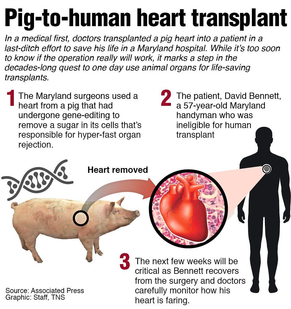 Graphic showing information on the first-ever pig-to-human heart transplant done last year, but the patient only lived for 61 days. — TNS