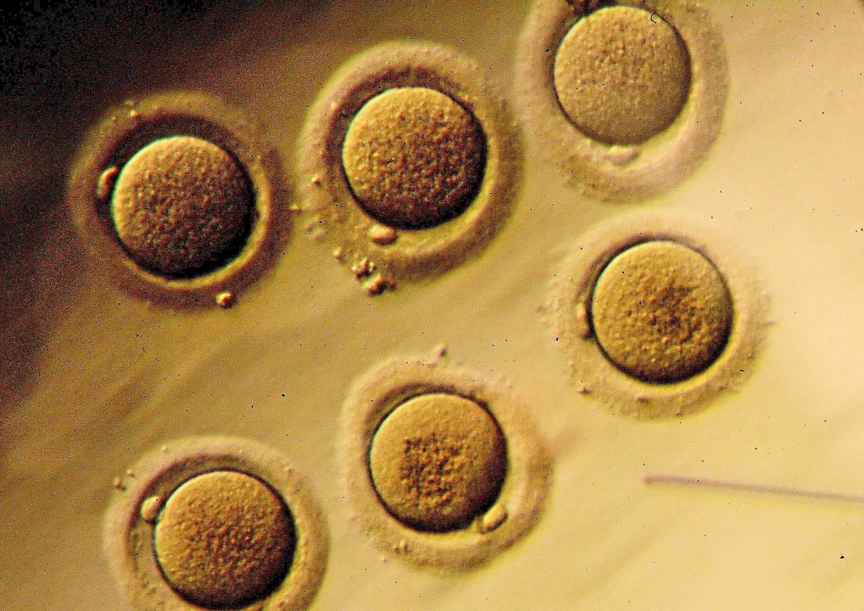 If a woman’s endometrium is too thin, her embryos (as seen under the microscope here) will not be able to implant successfully. — Bloomberg