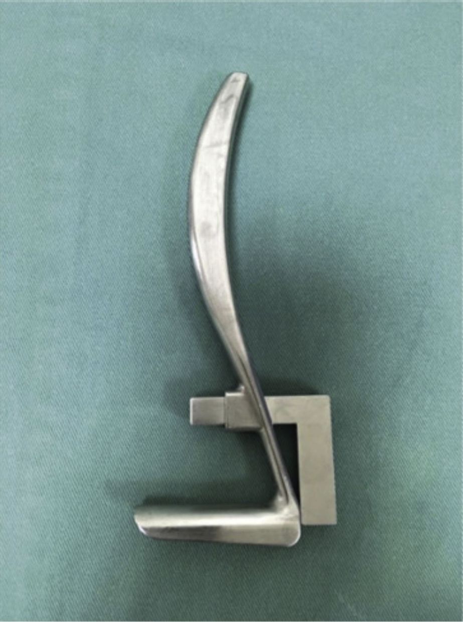 The supraretinacular retractor, with L-bar for endoscope placement, designed by Dr Teh.