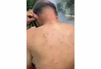 What a buzzkill: Hiker hurt in bee attack at George Town's Youth Park