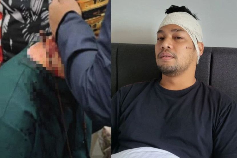 Shocking attack on actor: No bail granted to Kamal Adli's attacker in Singapore - Vimarsana News