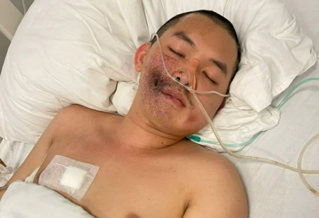 Laos activist survived shooting: rights group - Vimarsana News