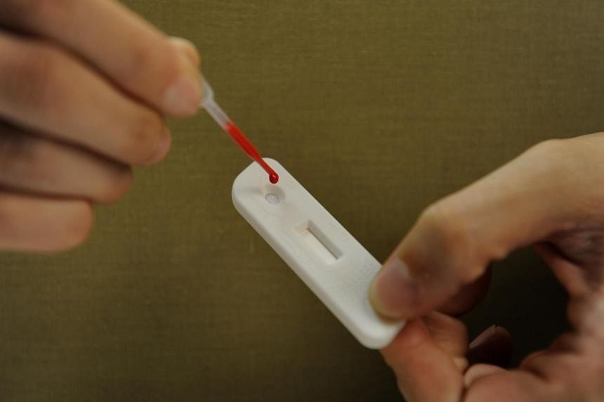 Singapore: New HIV infections in first 10 months of 2023 up by 10%, but 2022 infection rate lowest in 26 years - Vimarsana News