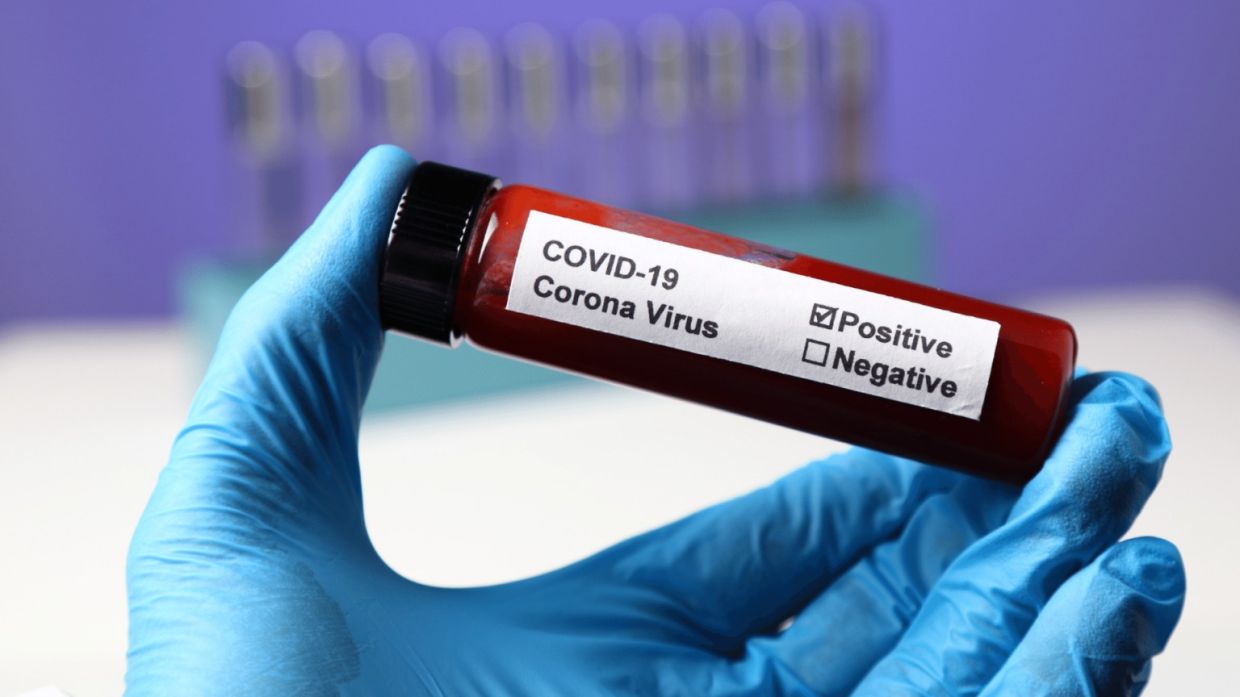 Covid-19 positivity rate in Philippines hits 18.1% as of Dec 22, says Octa Research - Vimarsana News