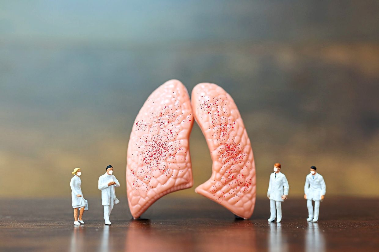 We spend billions annually treating smoking-related illnesses such as lung cancer. — 123rf.com