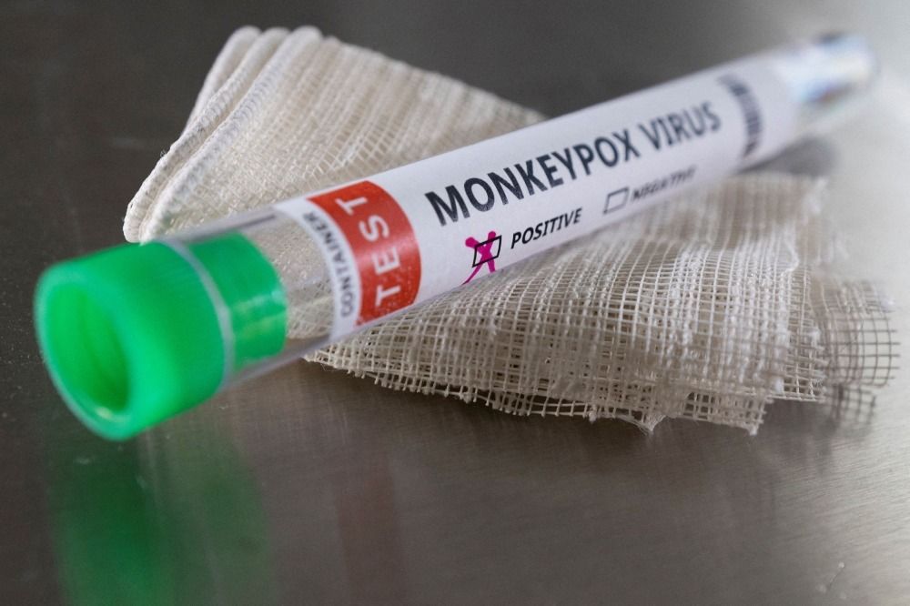 Cambodia records two more cases of monkeypox; govt tells people to be cautious fearing outbreak - Vimarsana News