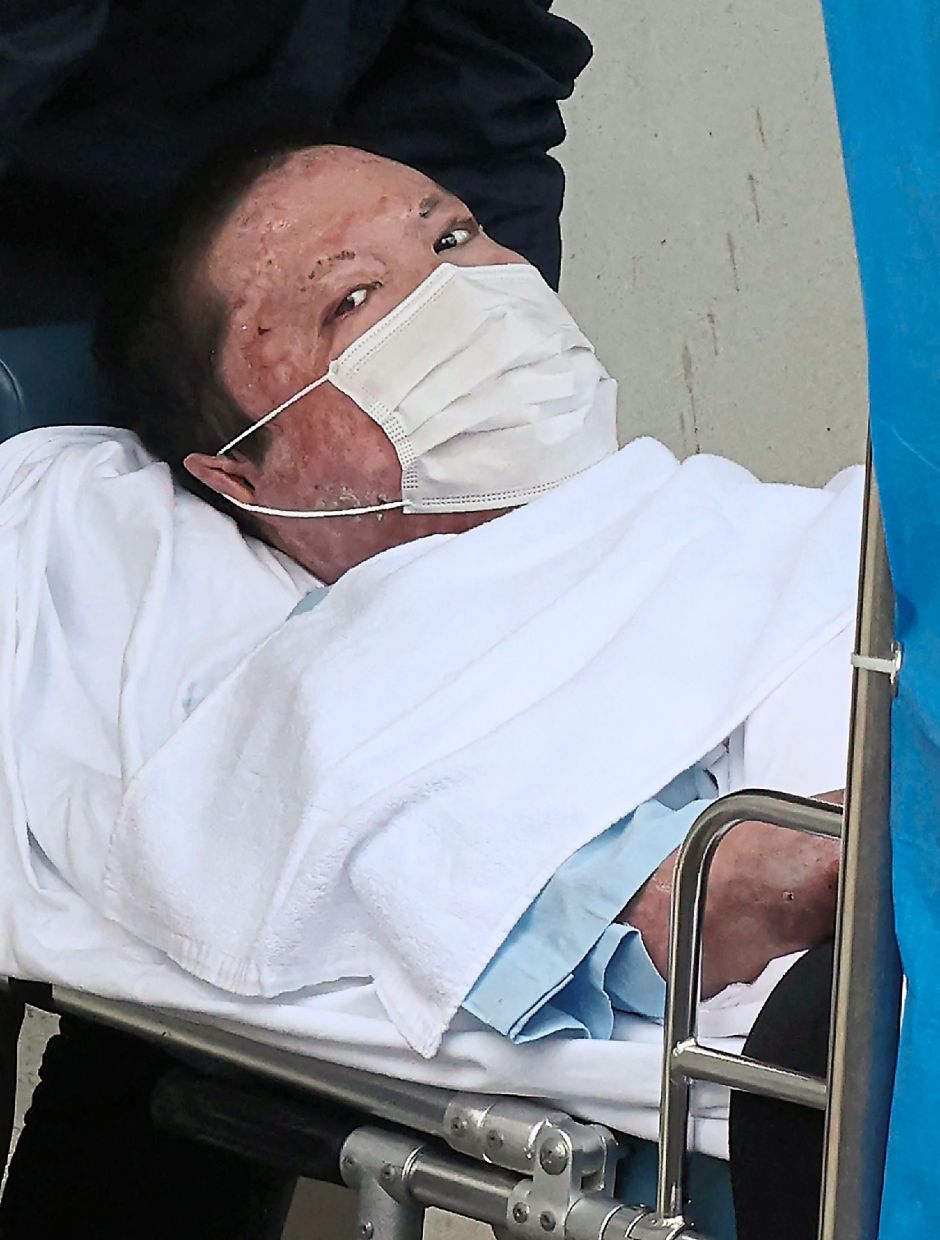 Perpetrator: Aoba being transported on a stretcher to the Fushimi police station in Kyoto in this file picture from May 27, 2020. — AFP