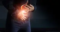 Increase in colon cancer among millennials