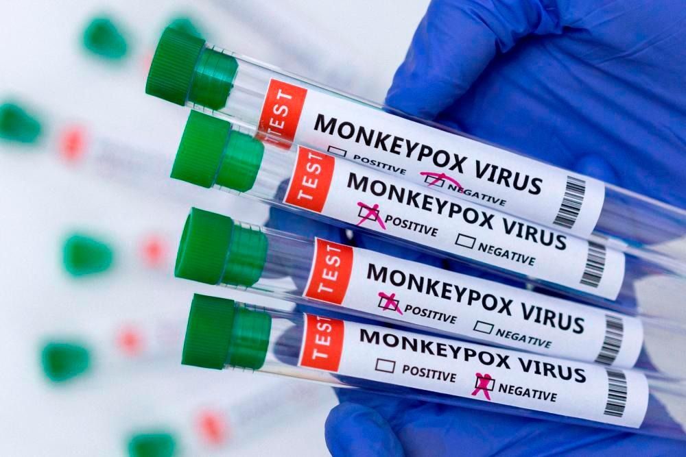 Monkeypox cases on rise in Cambodia; health ministry now confirms 12th case - Vimarsana News