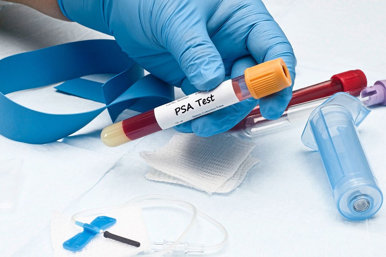 Men above 50 years of age are recommended to check their PSA levels regularly to pick up BPH or prostate cancer. — 123rf