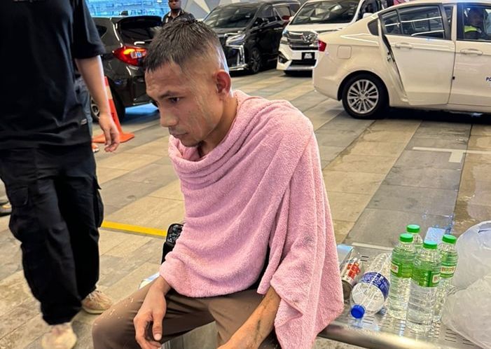 Acid attack motive remains a baffling mystery - Vimarsana News