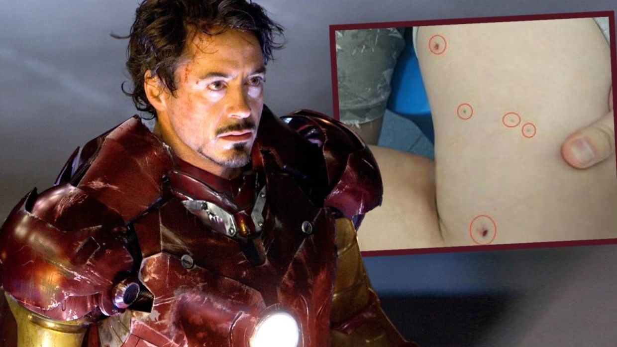 Iron-Man-Possen: Opfer der Explosion in China versucht wie ein Superheld ...