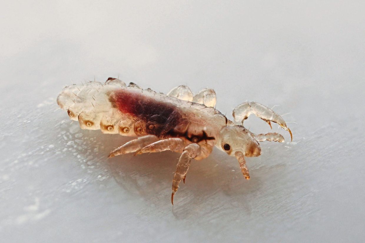 Tips for tackling head lice