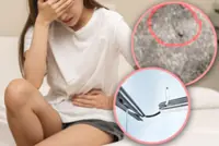 Thai woman suffers 18 years of pain after childbirth, finds needle left in vagina during suturing