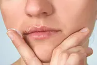 One in five of most adults have herpes