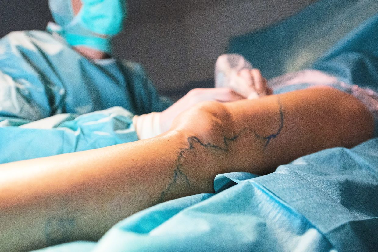 Current treatment methods for varicose veins usually have a fast recovery time. — dpa