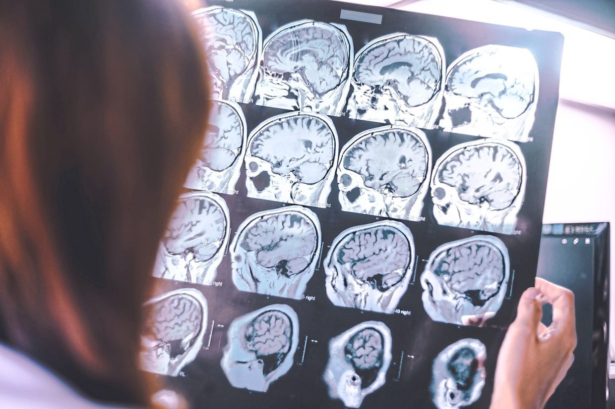 Dr Gibbs notes that it is difficult to know what to expect as his Alzheimer's progresses as previously, most people with the disease were only living three to five years after the diagnosis as they were being diagnosed late.