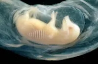 Human heart structure beats 21 days in pig embryo in Chinese chimera study