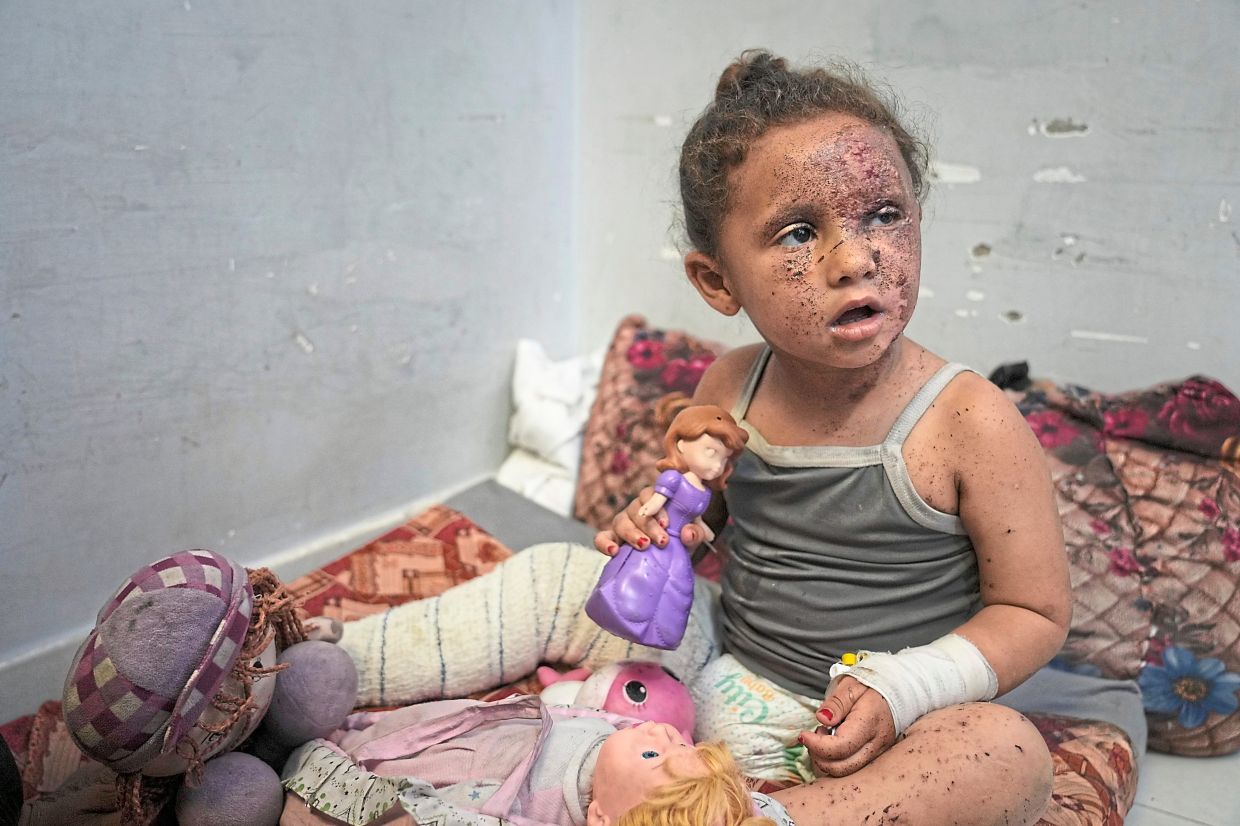 Layan sitting despondently among her dolls at Nasser hospital with second-degree burns on her face, foot and stomach, caused a week earlier during an Israeli army strike on her home in Khan Yunis, Gaza. — AP