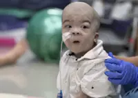 Malaysian NGO seeking help for little boy Shao Heng who needs gastrostomy surgery and born with congenital genetic defects