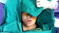 Vietnam doctors perform nine-hour surgery to remove tumour and reconstruct face of ethnic girl