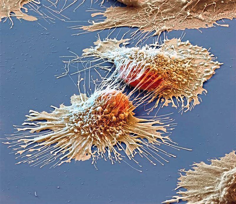 From defending cancer cells to protecting against type 1 diabetes