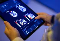 AI-dependent doctors risk failing to detect colon cancer – study