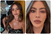 Sofia Vergara’s 2025 Emmys gig cancelled at last minute for a trip to the ER