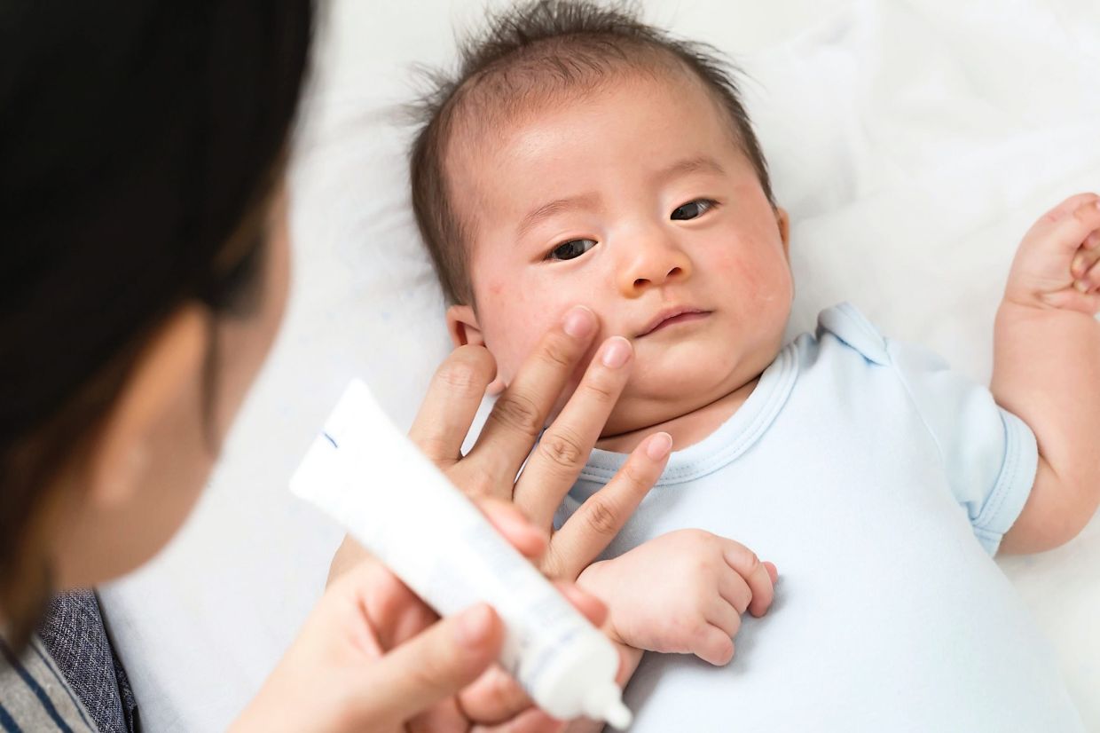 It’s very important for parents to observe what type of ingredients are in the skincare products they apply on their children, especially those with eczema, as some ingredients could trigger a flare-up. — Positive Parenting