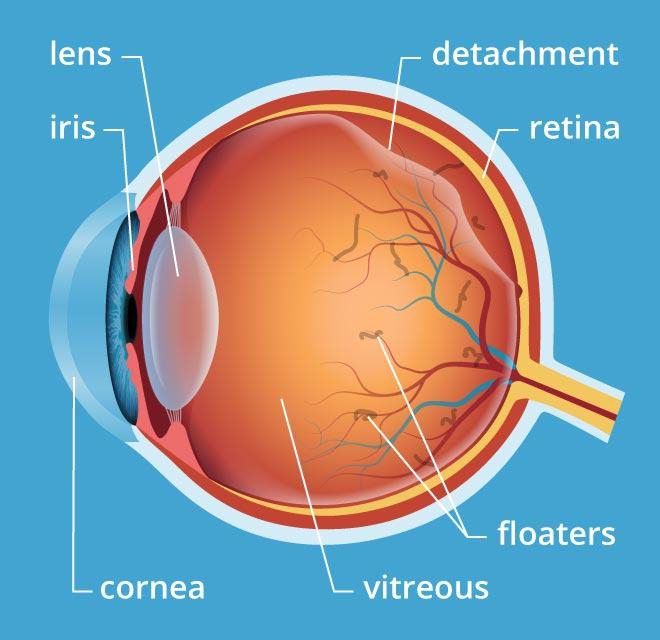 The retina is the innermost layer of the eye containing the light-sensitive cells we need to see. Retinal detachment will result in blindness if not treated.