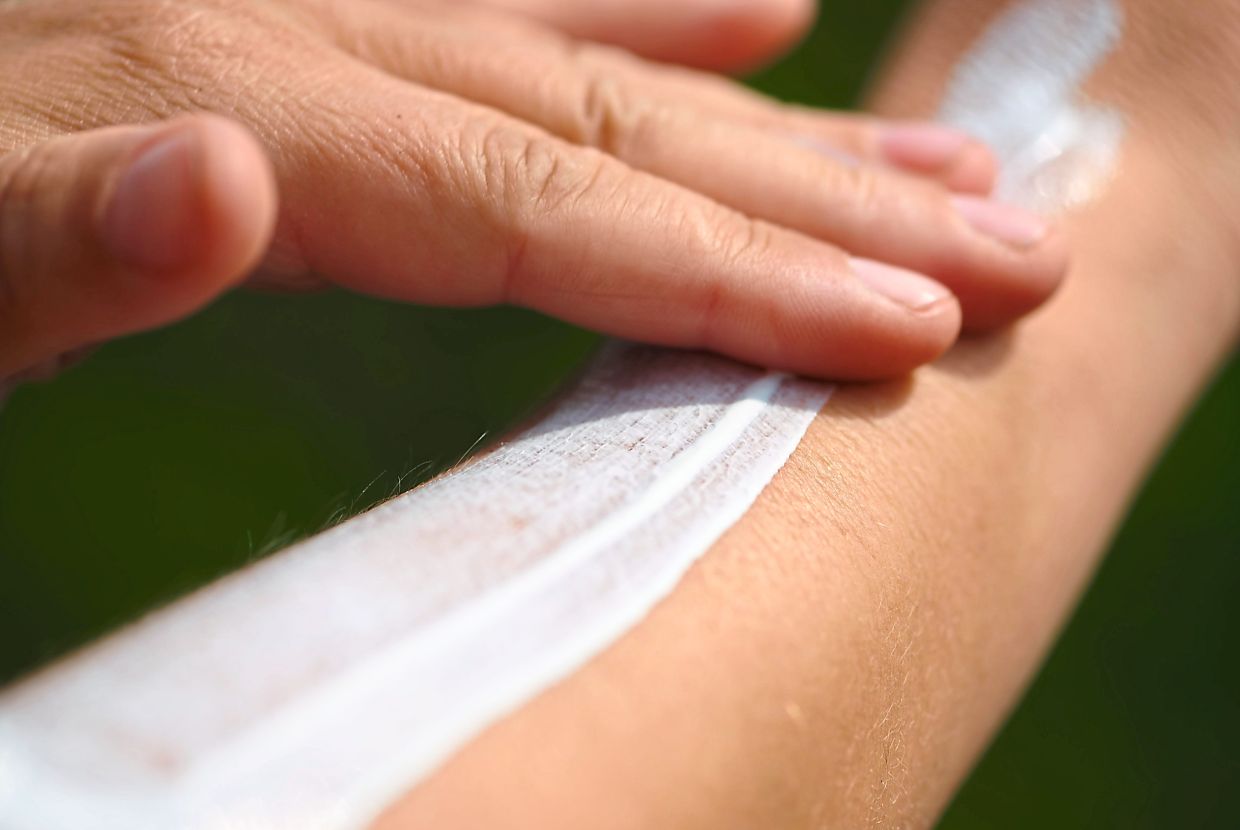 Those with vitiligo should be very diligent about using sunscreen when they go out as they lack sufficient melanin, which protects the skin against UV rays. — dpa