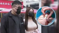Chinese woman spends US$140,000 entrusted to her by boyfriend on plastic surgery