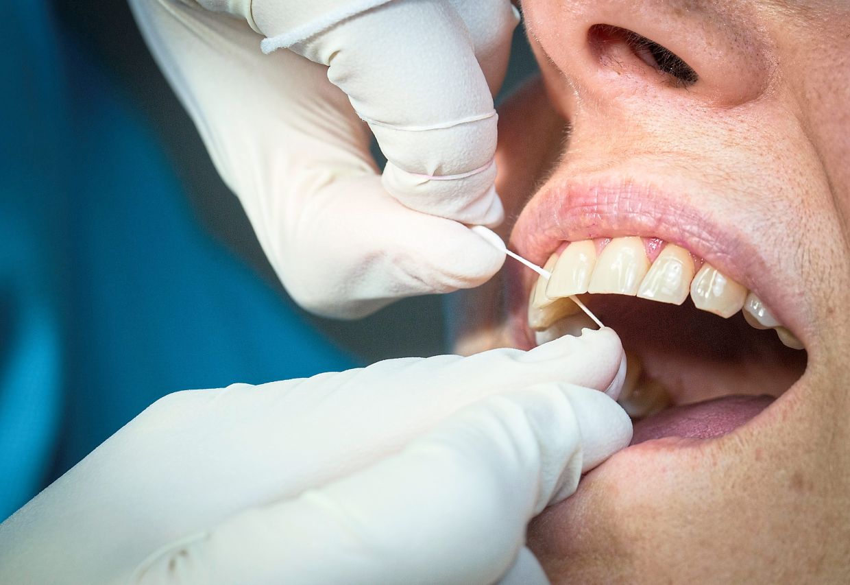 Do I need professional teeth cleaning?