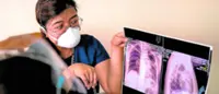 Philippines steps up TB fight, targets 12mil screenings by 2026