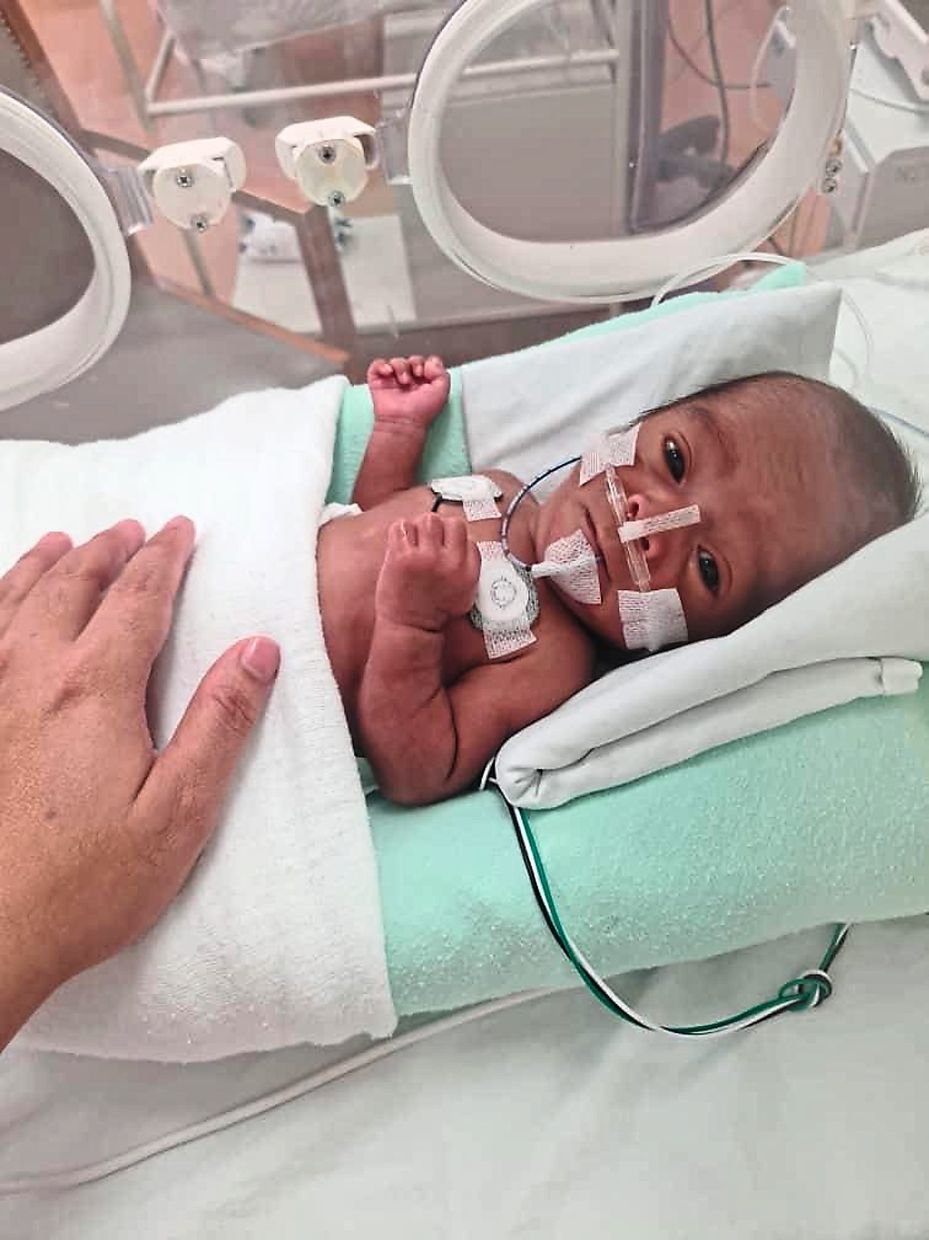 The younger of twins who were delivered prematurely at 28 weeks, this baby, who was six weeks old in this photo, had to stay in the hospital for four months before being allowed to go home. The delivery was so unexpected that the mother, who is a doctor, had to drive herself while in labour to the hospital as her husband was outstation at the time.