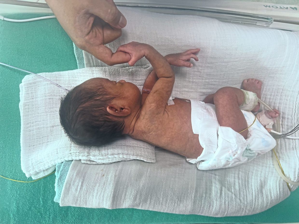 Delivered prematurely at 30 weeks gestation with very low birth weight, this two-week-old is currently still in the hospital and will only be allowed to go home after gaining enough weight to hit the scales at 1.8kg, among other factors.