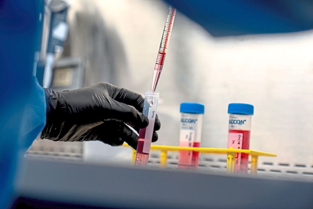 Exploring alternative treatments for autoimmune diseases