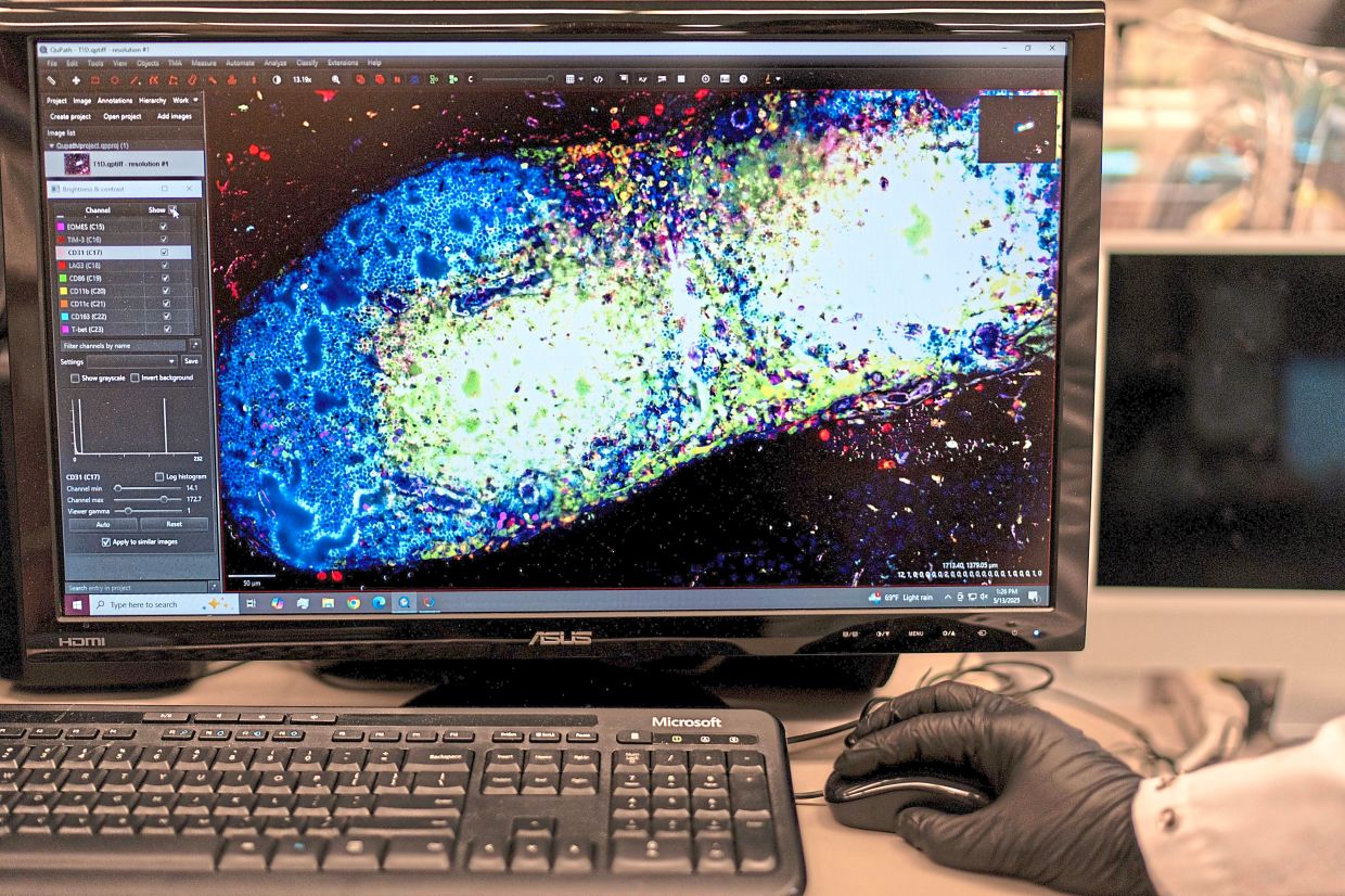 In this image of a pancreatic lymph node from a mouse in Prof Green’s lab, red marks the bad T cells that destroy insulin production, whileyellow indicates the peacemaker regulatory T cells that counterautoimmune responses.