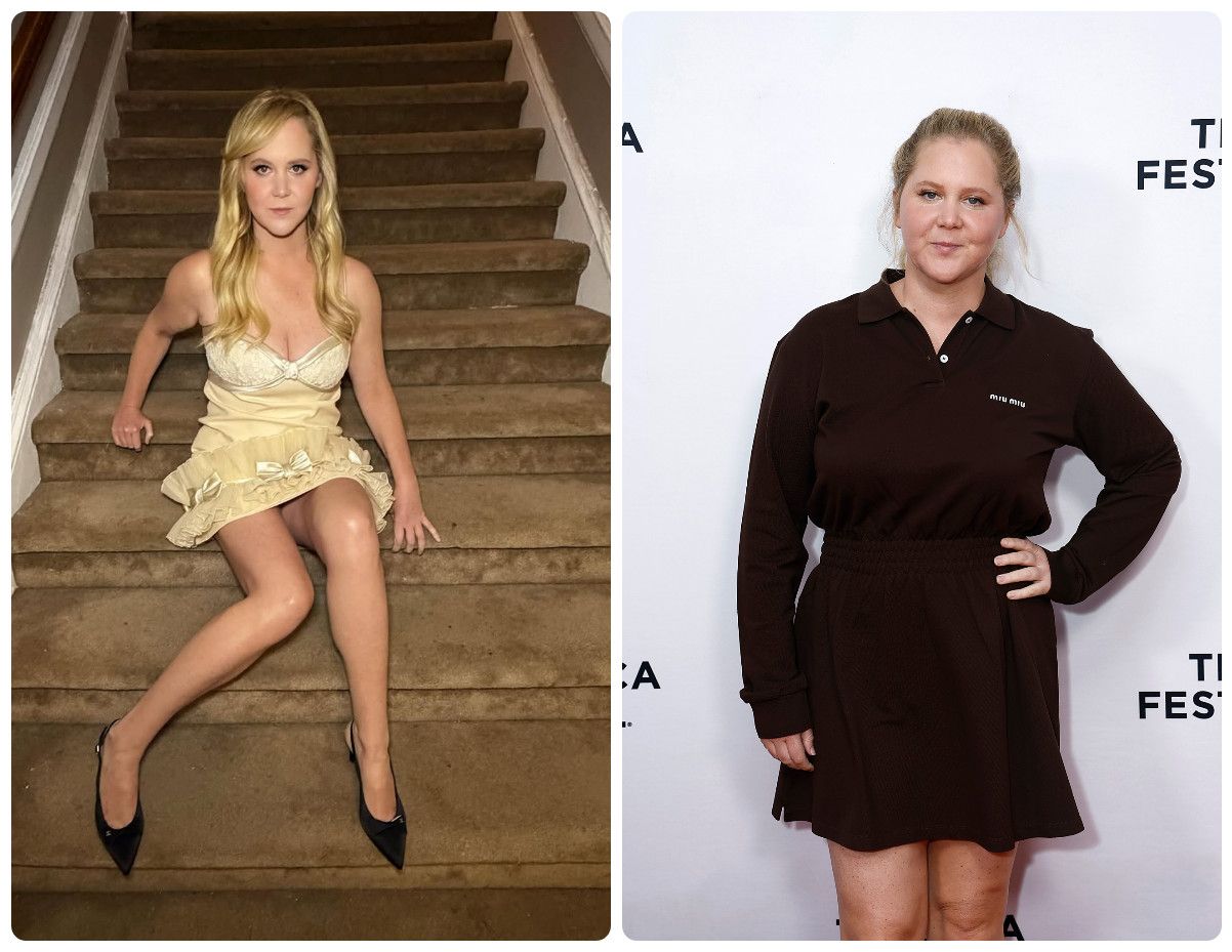 Amy Schumer credits 22kg weight loss to Cushing’s disease battle