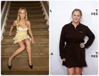 Amy Schumer credits 22kg weight loss to Cushing’s disease battle