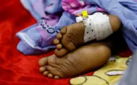 Child deaths will rise this year as aid cuts reverse progress, says Gates