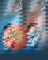 Stroke prevention: Cleaning out the plaque in your carotid artery