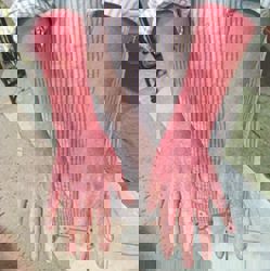 When stopping steroid creams makes your skin worse